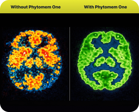 brain-before-after phytomem one