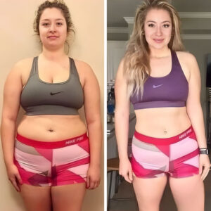 weight Loss before and after